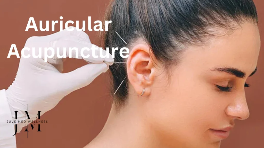 Auricular Acupuncture